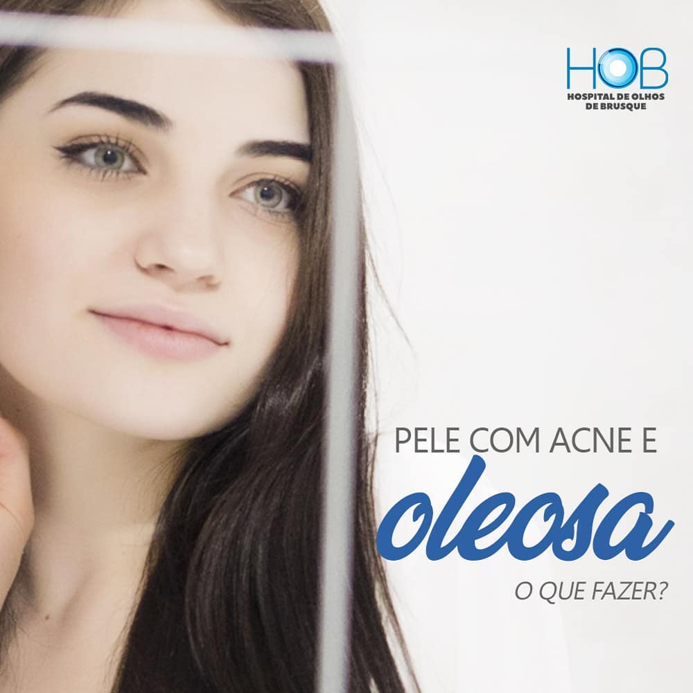 PELE OLEOSA